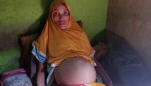 Sakinah Wanita Pengidap Tumor Di Bengkayang Butuh Bantuan