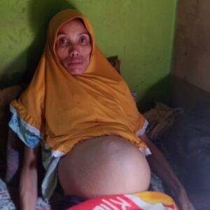 Sakinah Wanita Pengidap Tumor Di Bengkayang Butuh Bantuan 4 Sakinah Wanita Pengidap Tumor Di Bengkayang Butuh Bantuan