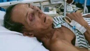 Apo, Tokoh Adat Yang Dihormati Tengah Berjuang Melawan Sakit