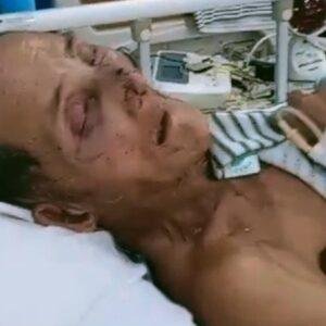 Apo, Tokoh Adat Yang Dihormati Tengah Berjuang Melawan Sakit