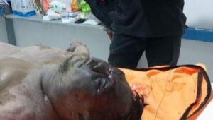 Mayat Pria Yang Ditemukan di Sungai Kapuas Masih Terlantar di RSUD Sanggau